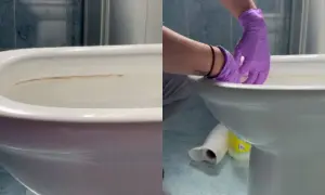 Manos con guantes morados limpiando el fondo del inodoro con sarro.